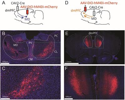 Targeting Reciprocally Connected Brain Regions Through CAV-2 Mediated Interventions